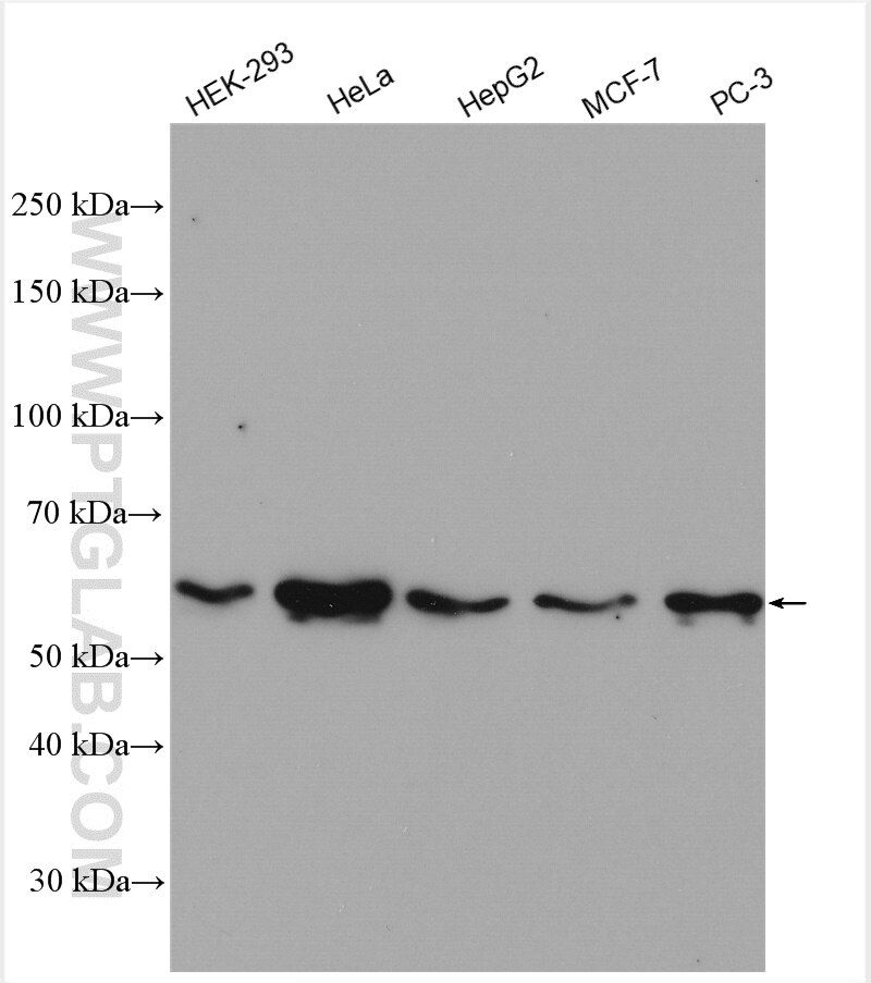 Western Blot (WB) analysis of various lysates using SMAD2 Polyclonal antibody (12570-1-AP)