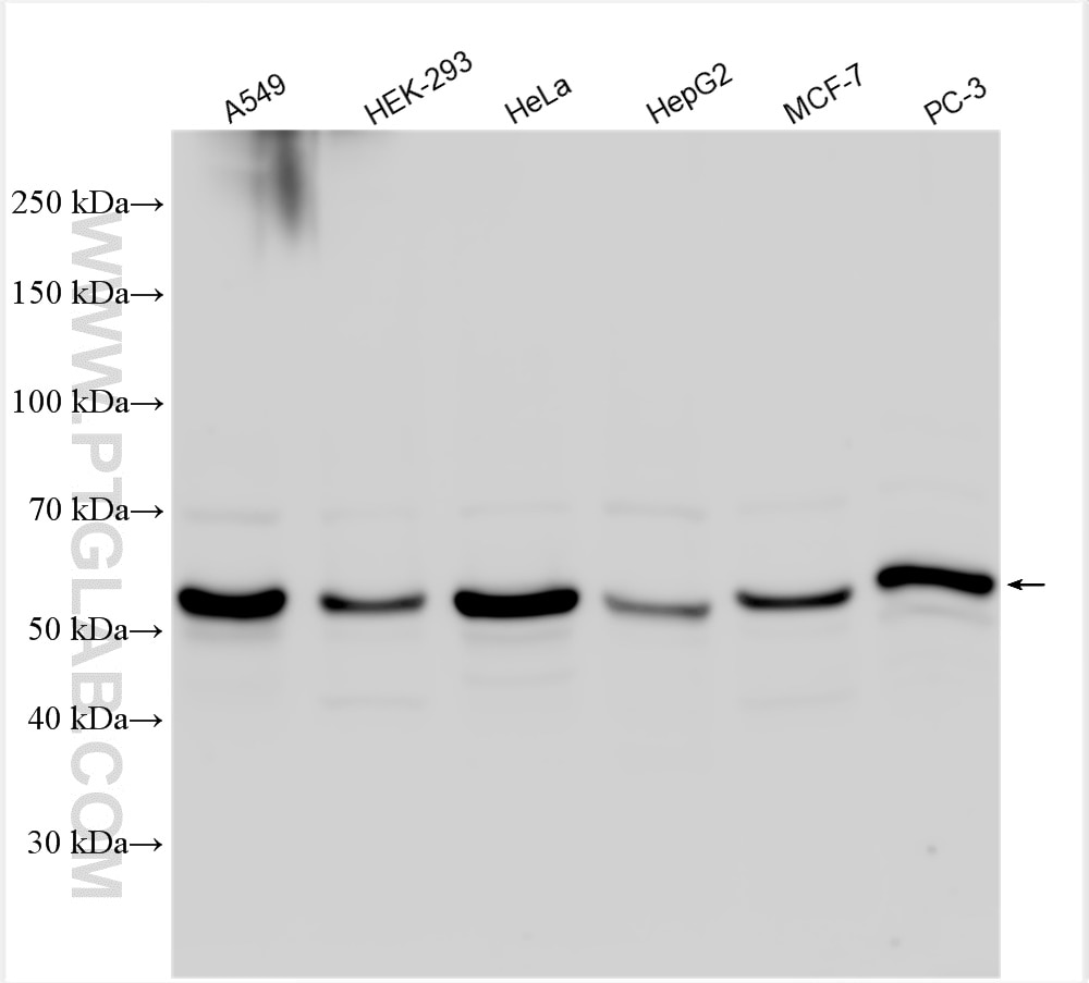 Western Blot (WB) analysis of various lysates using SMAD2 Polyclonal antibody (12570-1-AP)