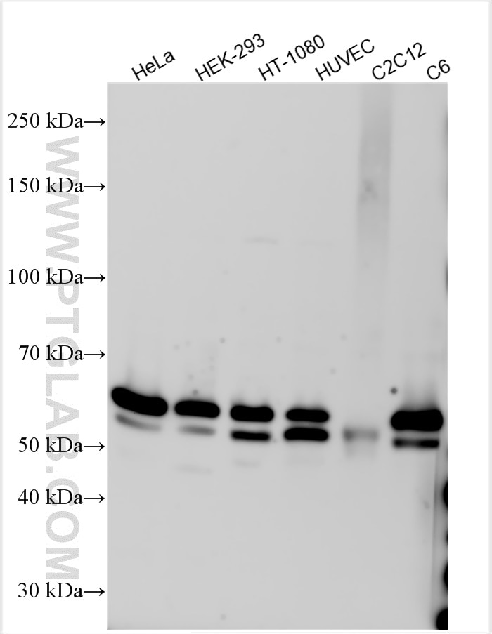Western Blot (WB) analysis of various lysates using SMAD2 Polyclonal antibody (12570-1-AP)