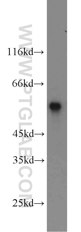 Western Blot (WB) analysis of Jurkat cells using SMAD2 Polyclonal antibody (12570-1-AP)