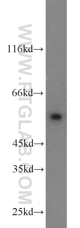 SMAD2 Polyclonal antibody