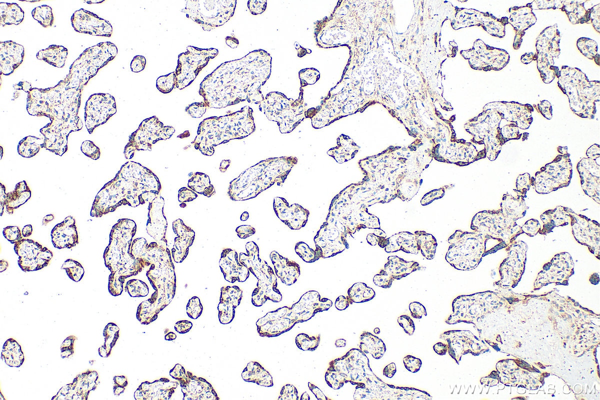 Immunohistochemistry (IHC) staining of human placenta tissue using SMAD4 Polyclonal antibody (51144-1-AP)