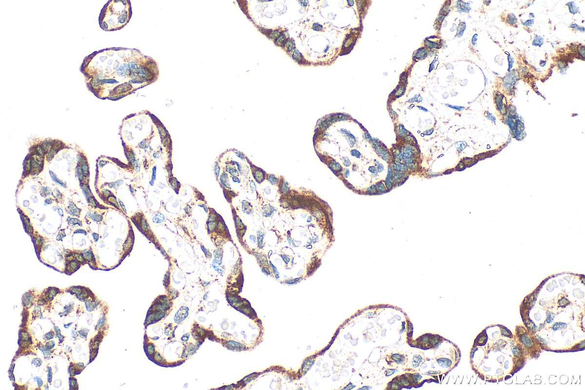 Immunohistochemistry (IHC) staining of human placenta tissue using SMAD4 Polyclonal antibody (51144-1-AP)