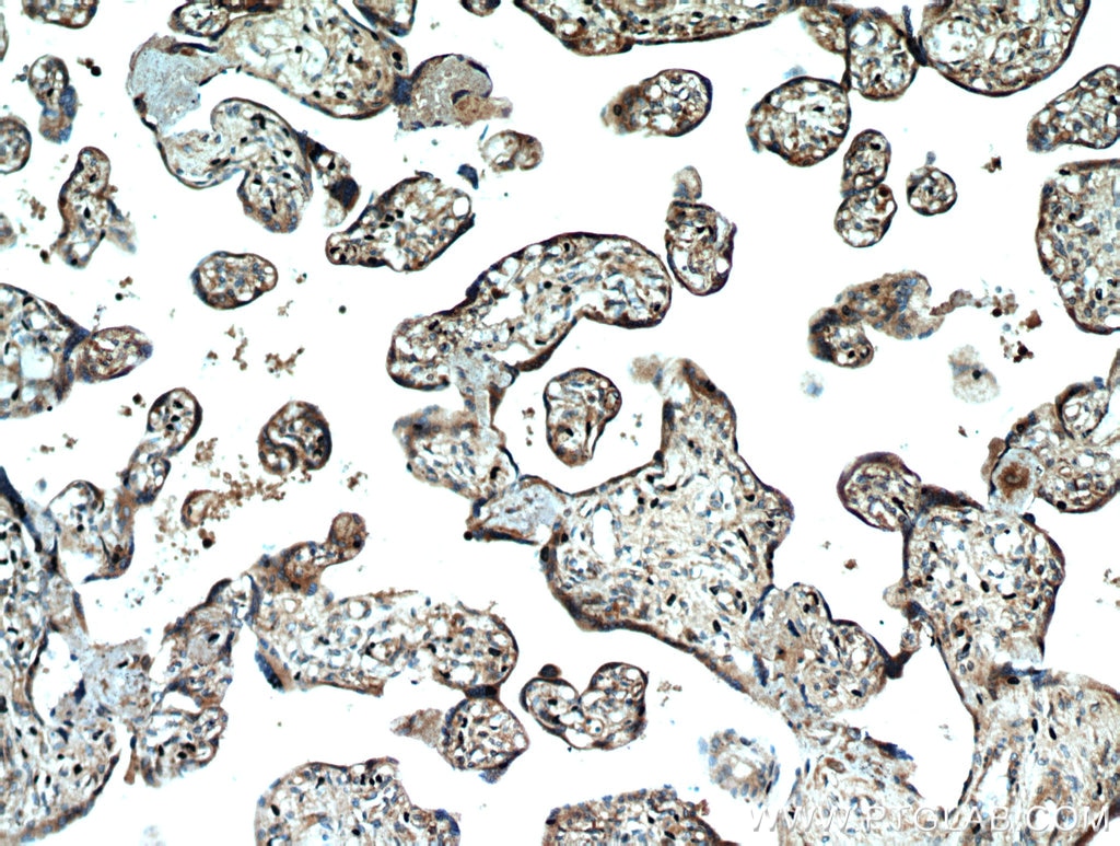 Immunohistochemistry (IHC) staining of human placenta tissue using SMAD4 Polyclonal antibody (51144-1-AP)