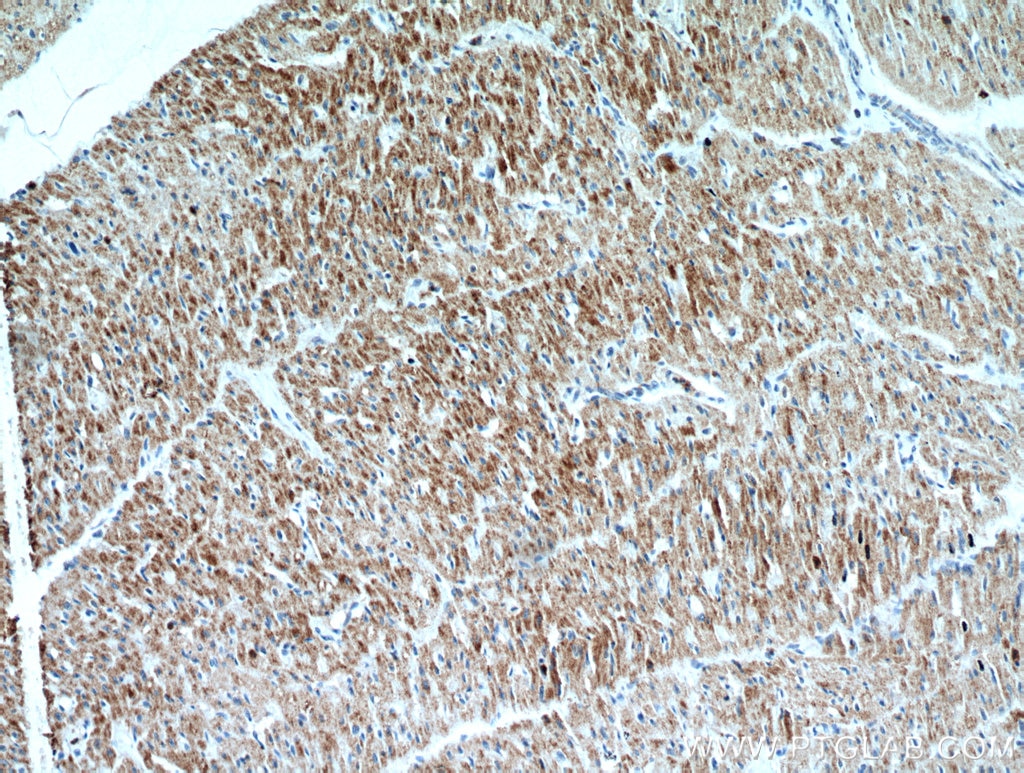 IHC staining of human heart using 51144-1-AP