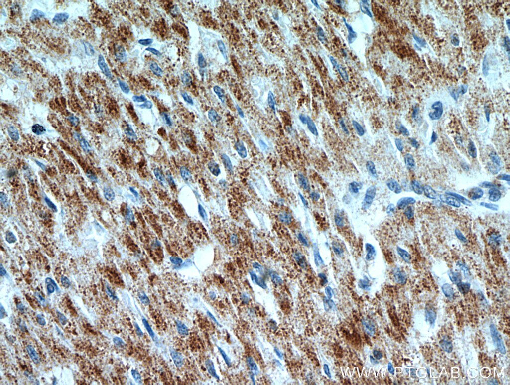 IHC staining of human heart using 51144-1-AP