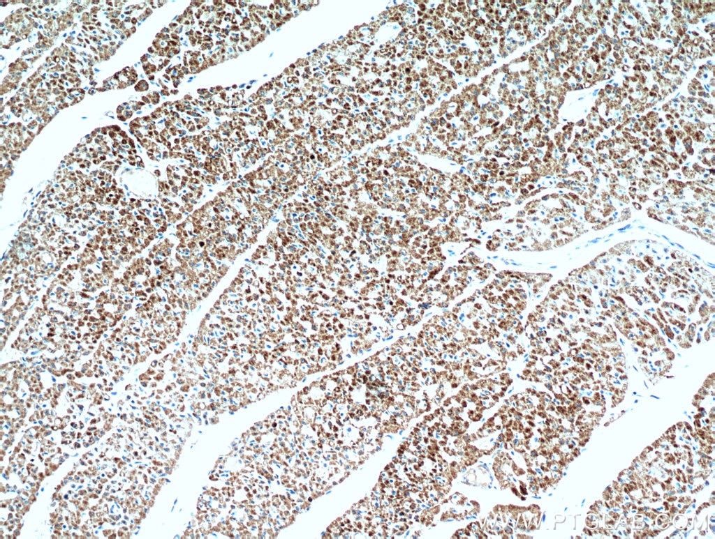 IHC staining of human heart using 51144-1-AP