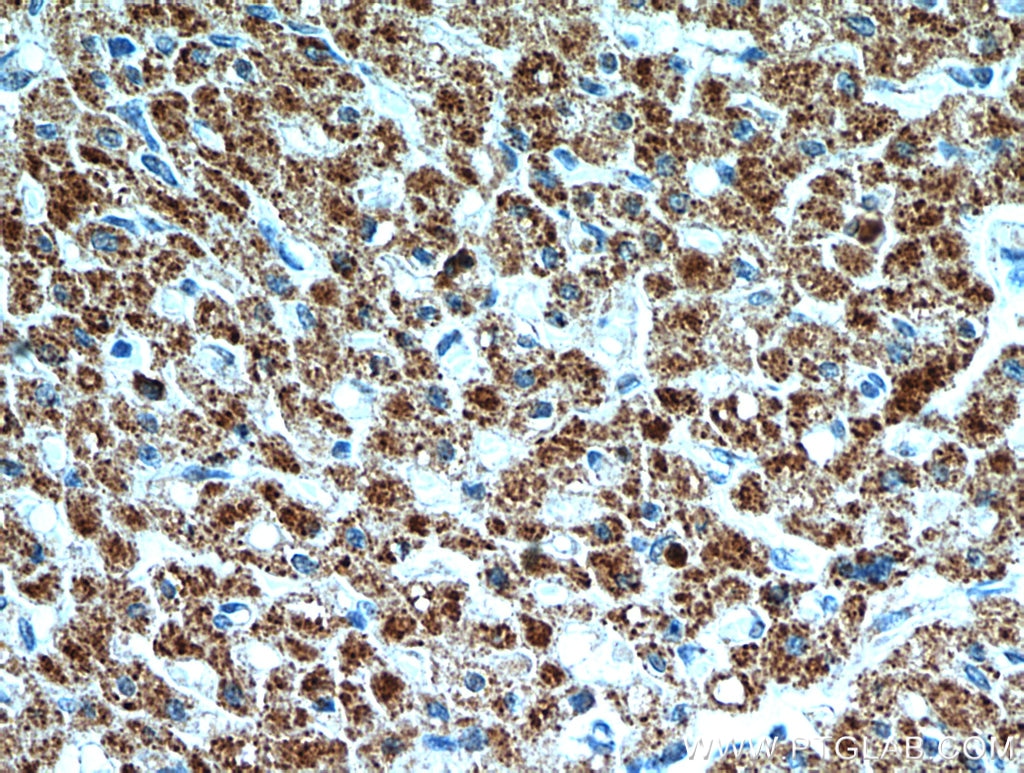 Immunohistochemistry (IHC) staining of human heart tissue using SMAD4 Polyclonal antibody (51144-1-AP)