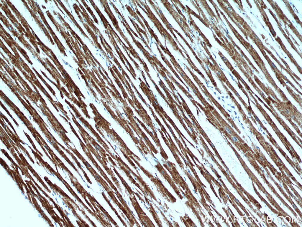 Immunohistochemistry (IHC) staining of human heart tissue using SMAD4 Polyclonal antibody (51144-1-AP)