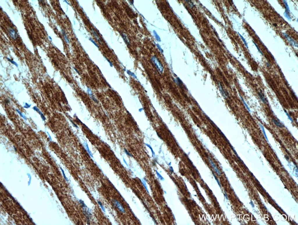 Immunohistochemistry (IHC) staining of human heart tissue using SMAD4 Polyclonal antibody (51144-1-AP)