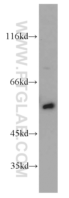Western Blot (WB) analysis of HeLa cells using SMAD4 Polyclonal antibody (51144-1-AP)