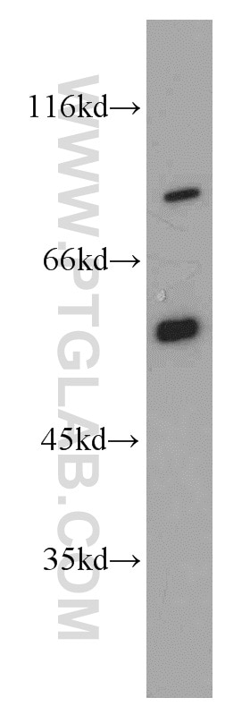 Western Blot (WB) analysis of PC-3 cells using SMAD4 Polyclonal antibody (51144-1-AP)