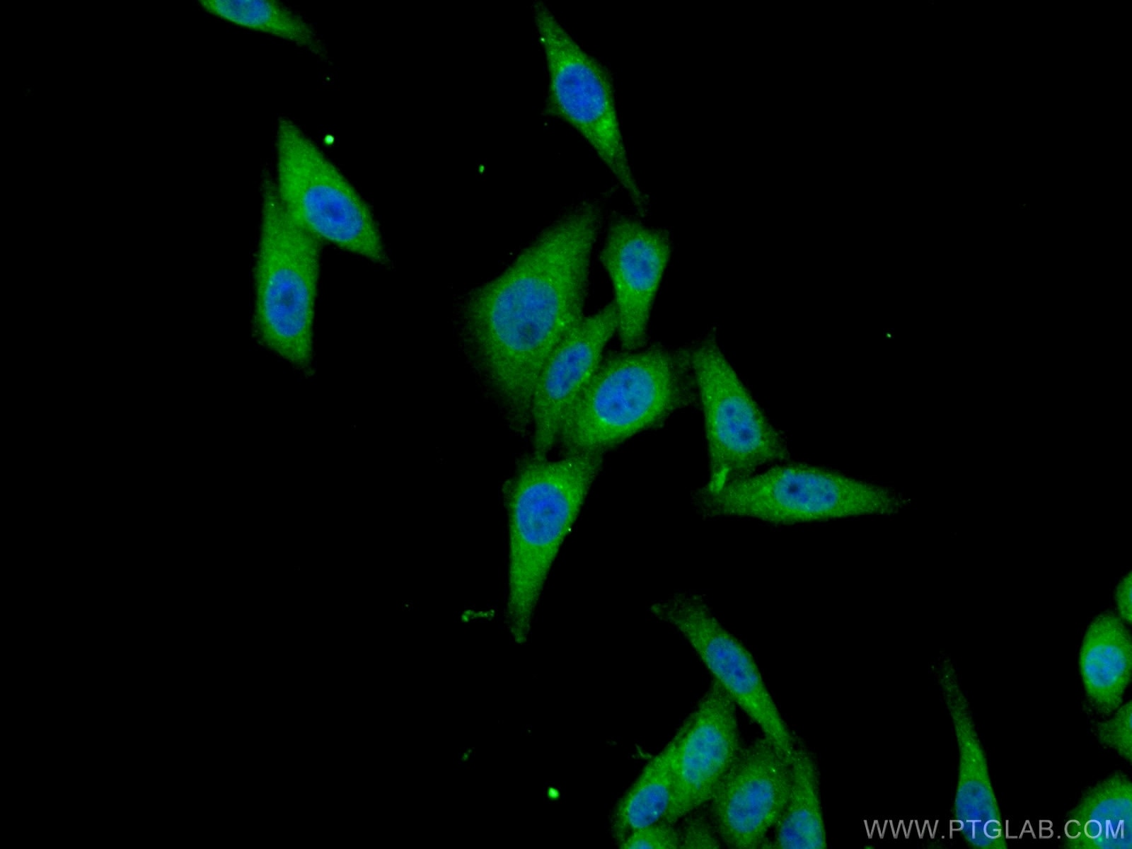 Immunofluorescence (IF) / fluorescent staining of HepG2 cells using SMAD2 Monoclonal antibody (67343-1-Ig)