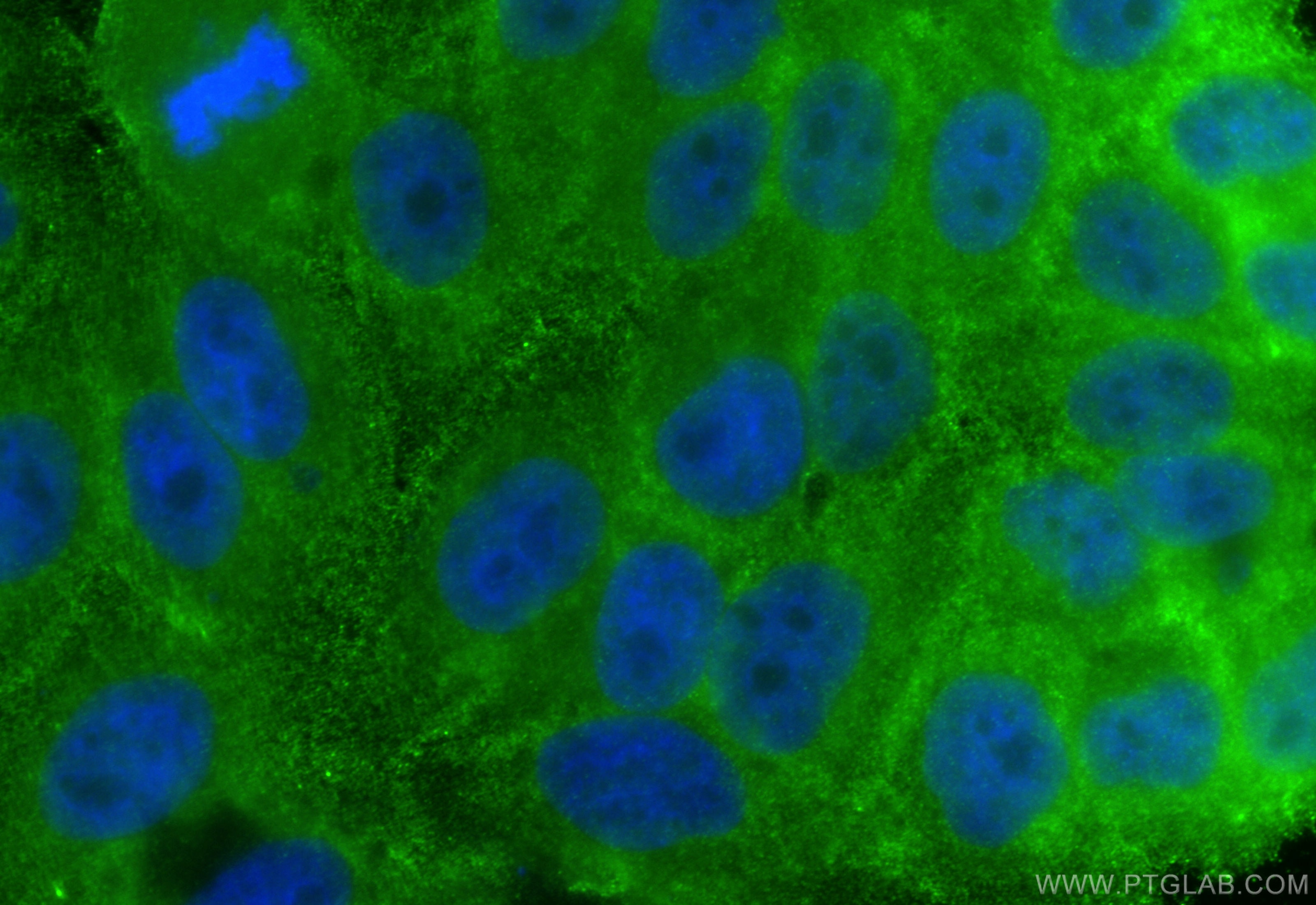 Immunofluorescence (IF) / fluorescent staining of HepG2 cells using SMAD2 Monoclonal antibody (67343-1-Ig)