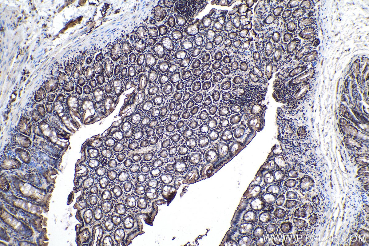 IHC staining of rat colon using 67343-1-Ig