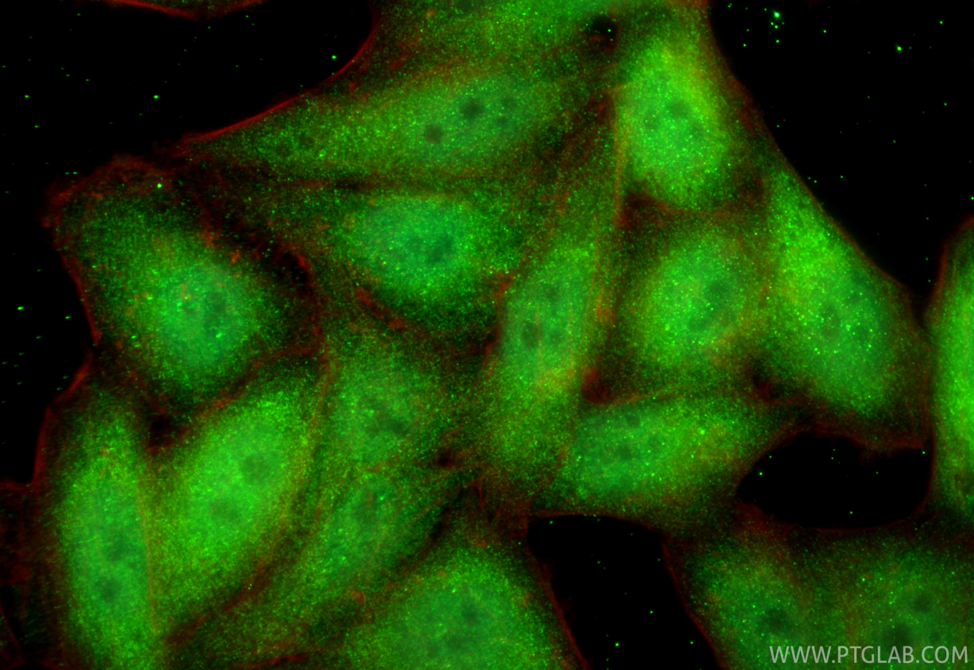 Immunofluorescence (IF) / fluorescent staining of HepG2 cells using Multi-rAb® SMAD2 Multi-Recombinant antibody (RMX00035)