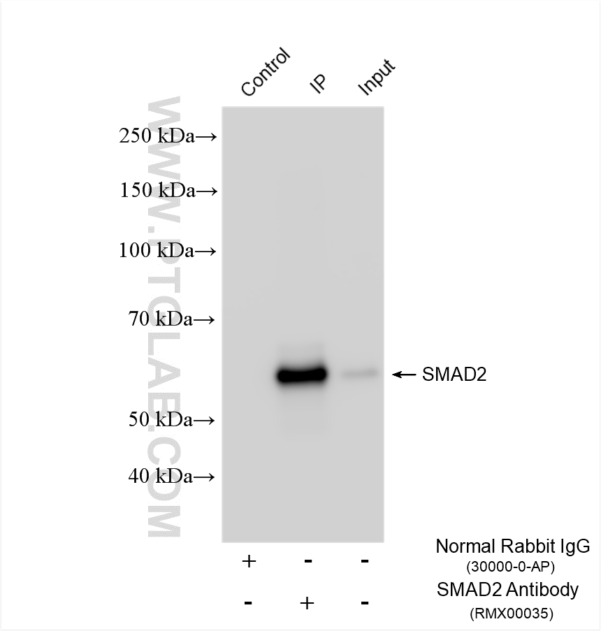 Immunoprecipitation (IP) experiment of A549 cells using Multi-rAb® SMAD2 Multi-Recombinant antibody (RMX00035)