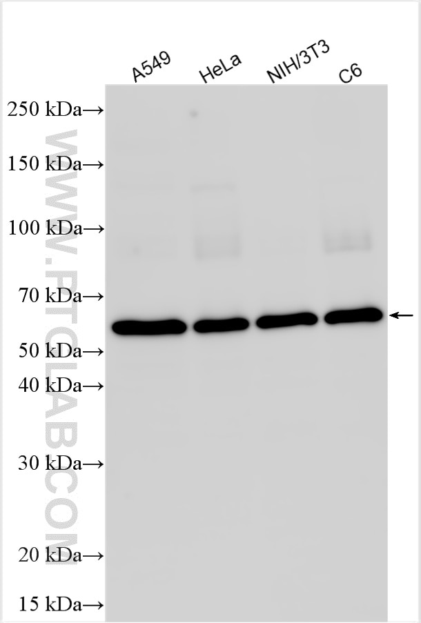 Western Blot (WB) analysis of various lysates using Multi-rAb® SMAD2 Multi-Recombinant antibody (RMX00035)