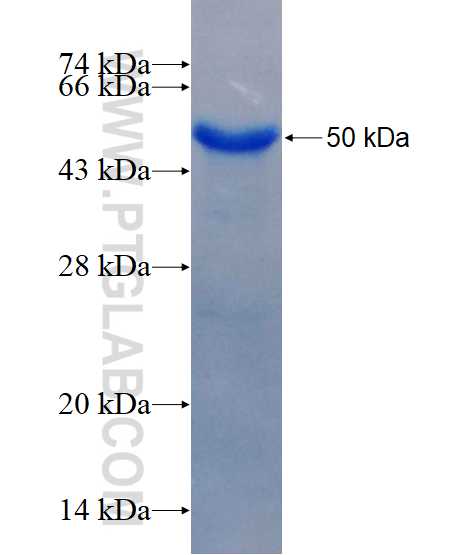 SMAD2 fusion protein Ag19542 SDS-PAGE