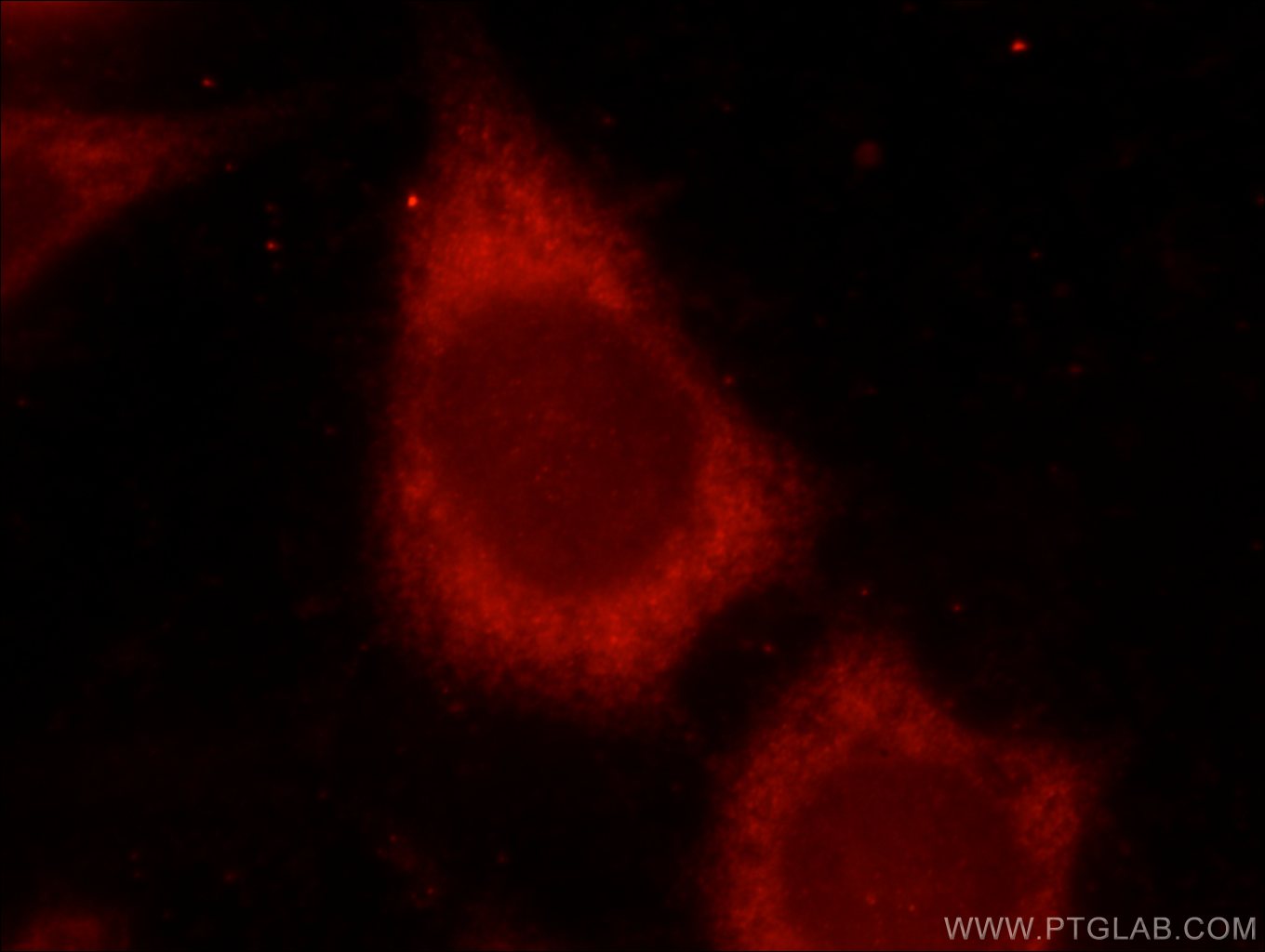 Immunofluorescence (IF) / fluorescent staining of HeLa cells using SMAD3 Polyclonal antibody (25494-1-AP)