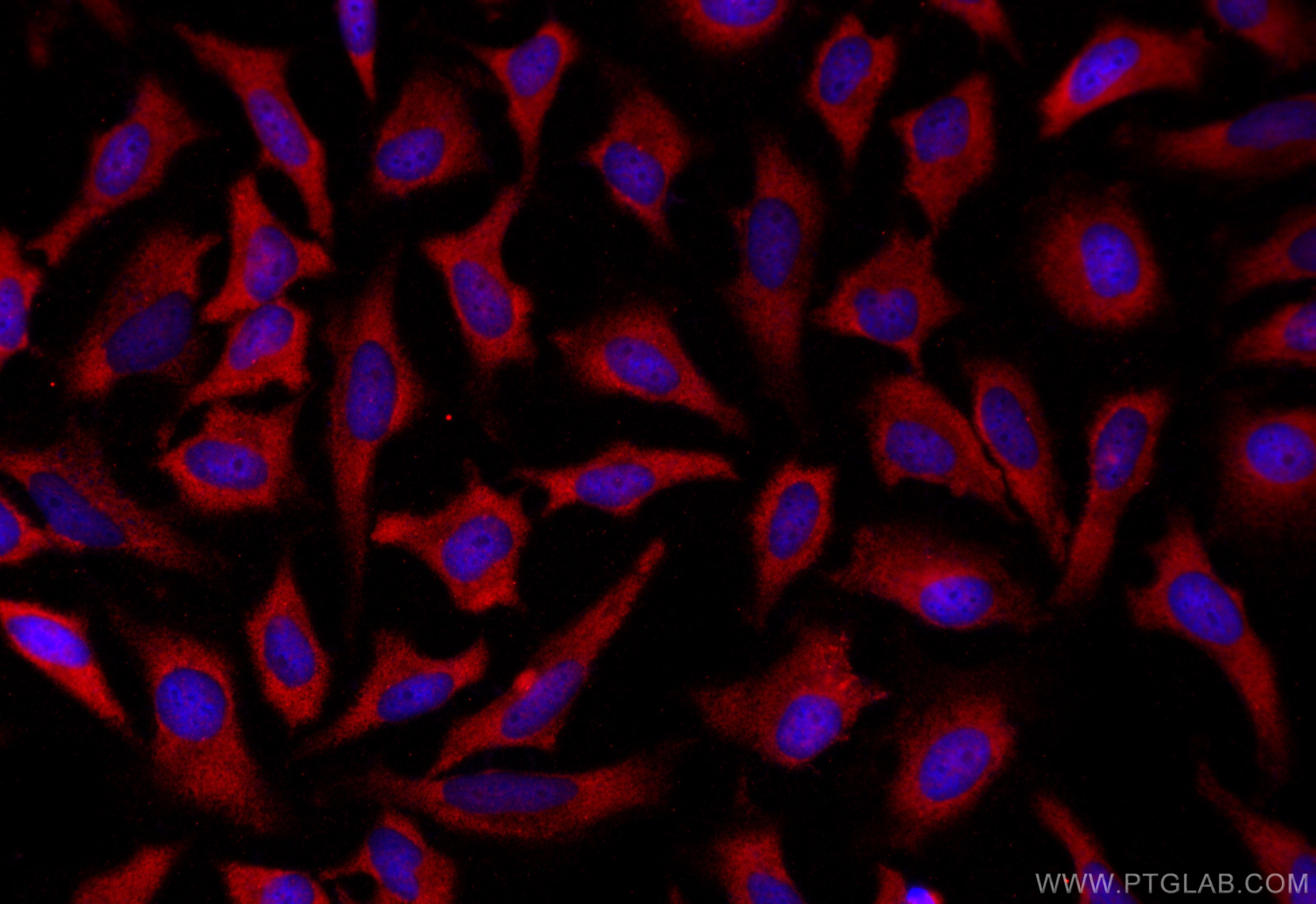 Immunofluorescence (IF) / fluorescent staining of HeLa cells using SMAD3 Polyclonal antibody (25494-1-AP)