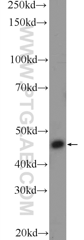 Western Blot (WB) analysis of Jurkat cells using SMAD3 Polyclonal antibody (25494-1-AP)