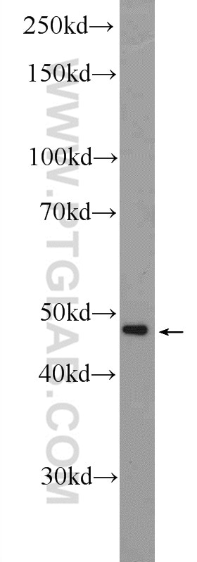 WB analysis of SH-SY5Y using 25494-1-AP