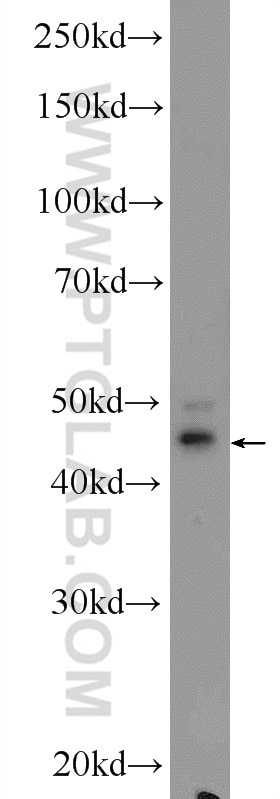 Western Blot (WB) analysis of A431 cells using SMAD3 Polyclonal antibody (25494-1-AP)