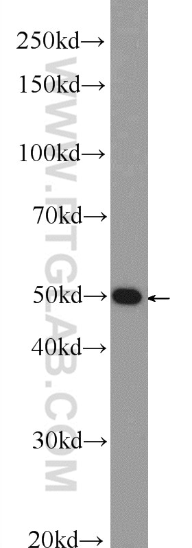 Western Blot (WB) analysis of A549 cells using SMAD3 Polyclonal antibody (25494-1-AP)