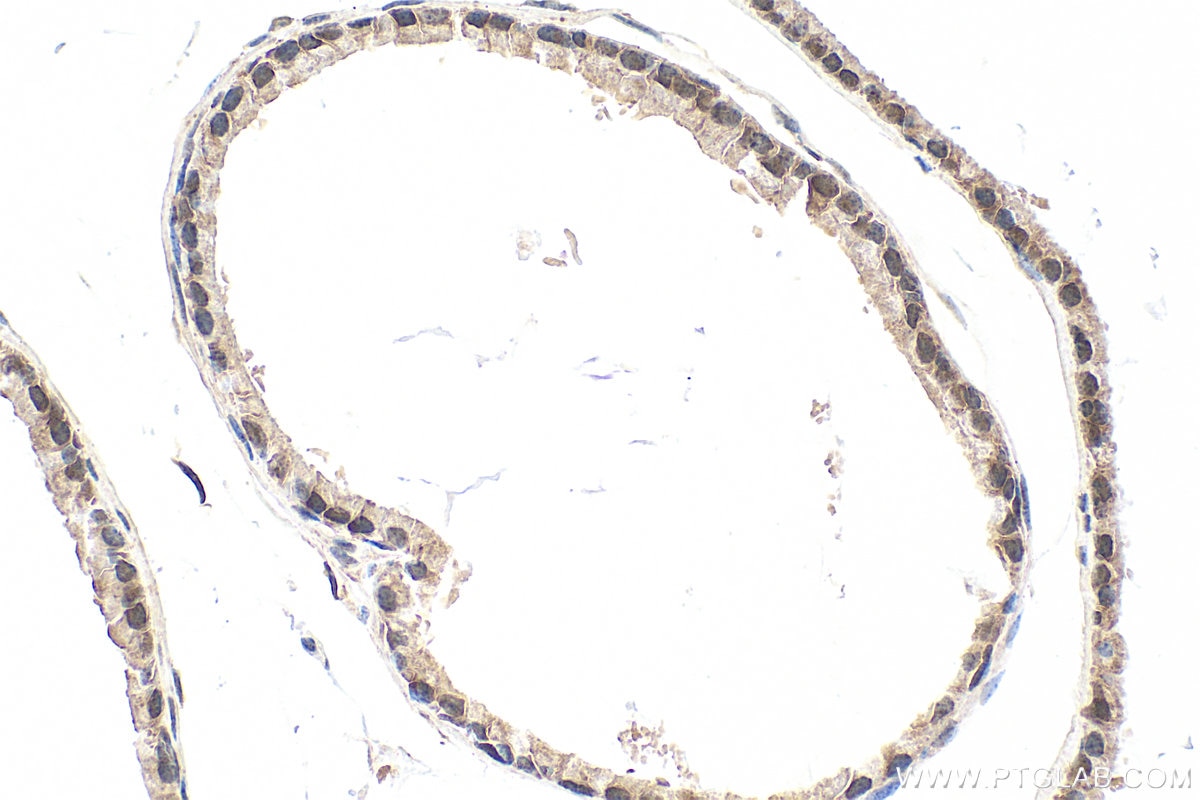 IHC staining of mouse prostate using 33480-1-AP Immunohistochemistry (IHC) staining of mouse prostate tissue using SMAD3 Polyclonal antibody (33480-1-AP)