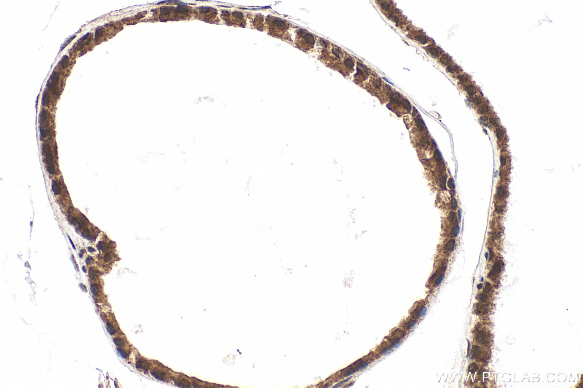 Immunohistochemistry (IHC) staining of mouse prostate tissue using SMAD3 Recombinant monoclonal antibody (87035-1-RR)
