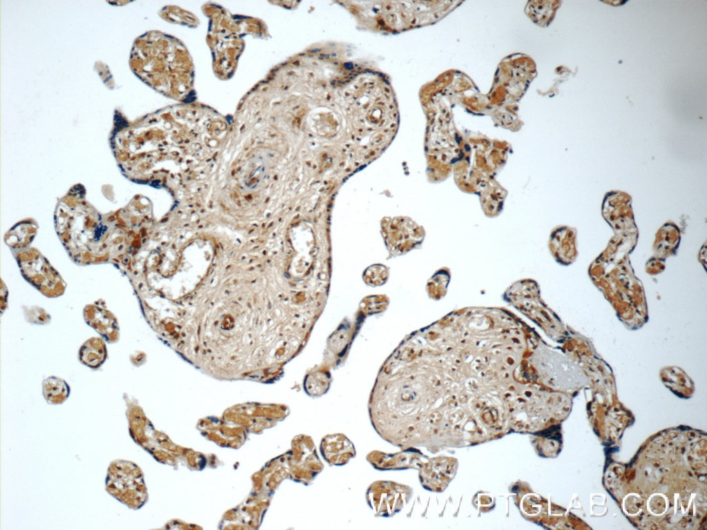Immunohistochemistry (IHC) staining of human placenta tissue using SMAD4 Polyclonal antibody (10231-1-AP)