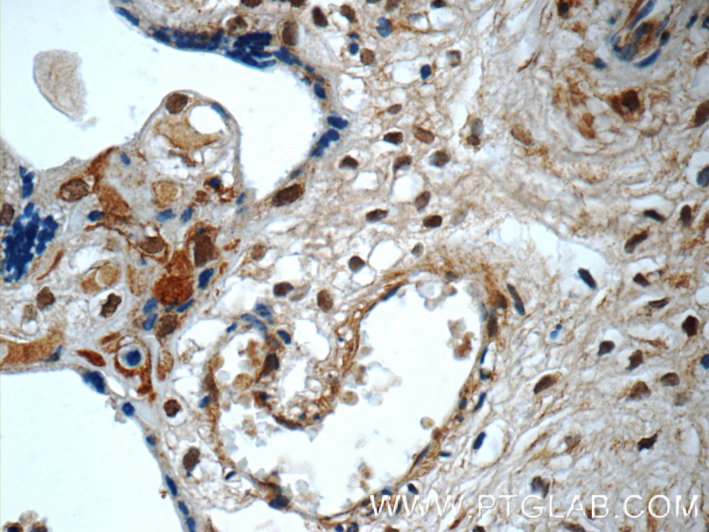 Immunohistochemistry (IHC) staining of human placenta tissue using SMAD4 Polyclonal antibody (10231-1-AP)