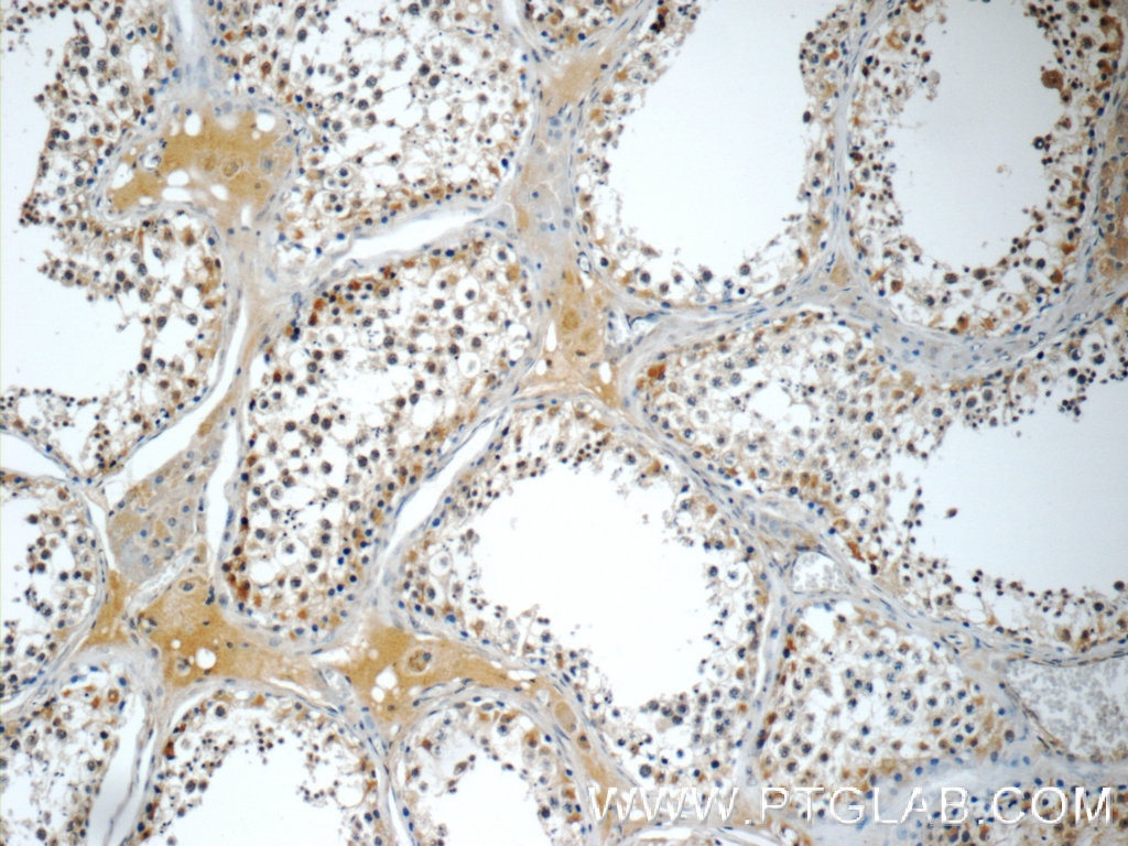 Immunohistochemistry (IHC) staining of human testis tissue using SMAD4 Polyclonal antibody (10231-1-AP)
