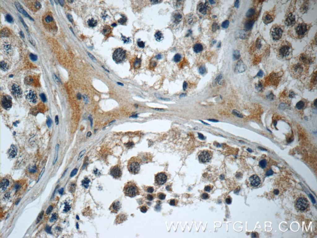 Immunohistochemistry (IHC) staining of human testis tissue using SMAD4 Polyclonal antibody (10231-1-AP)