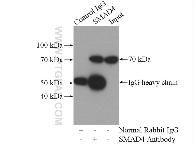Immunoprecipitation (IP) experiment of mouse liver tissue using SMAD4 Polyclonal antibody (10231-1-AP)