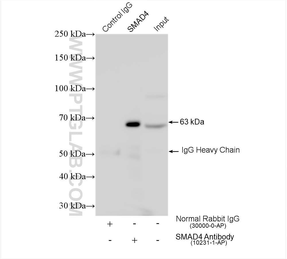 Immunoprecipitation (IP) experiment of HeLa cells using SMAD4 Polyclonal antibody (10231-1-AP)