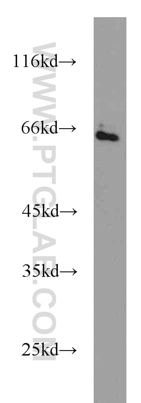 Western Blot (WB) analysis of HepG2 cells using SMAD4 Polyclonal antibody (10231-1-AP)