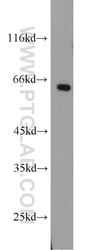 Western Blot (WB) analysis of SMMC-7721 cells using SMAD4 Polyclonal antibody (10231-1-AP)