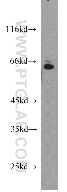 Western Blot (WB) analysis of A549 cells using SMAD4 Polyclonal antibody (10231-1-AP)