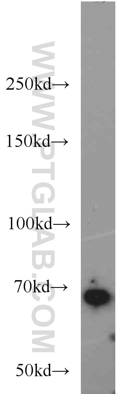 Western Blot (WB) analysis of mouse liver tissue using SMAD4 Polyclonal antibody (10231-1-AP)