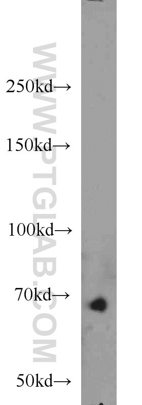 Western Blot (WB) analysis of mouse liver tissue using SMAD4 Polyclonal antibody (10231-1-AP)