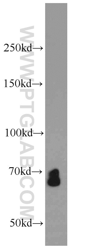 Western Blot (WB) analysis of HepG2 cells using SMAD4 Polyclonal antibody (10231-1-AP)