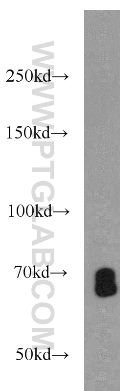 Western Blot (WB) analysis of HepG2 cells using SMAD4 Polyclonal antibody (10231-1-AP)