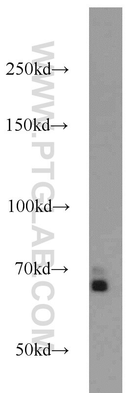 Western Blot (WB) analysis of HEK-293 cells using SMAD4 Polyclonal antibody (10231-1-AP)