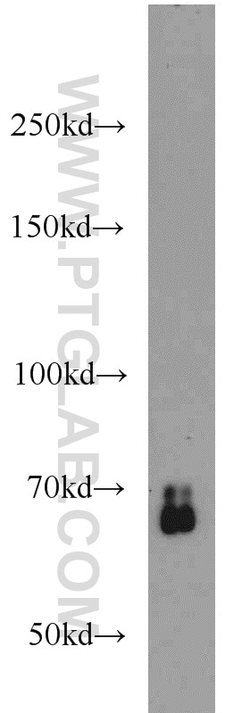 SMAD4 Polyclonal antibody