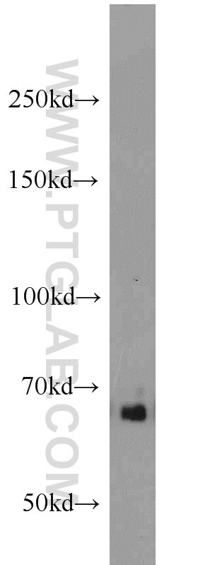 Western Blot (WB) analysis of HEK-293 cells using SMAD4 Polyclonal antibody (10231-1-AP)