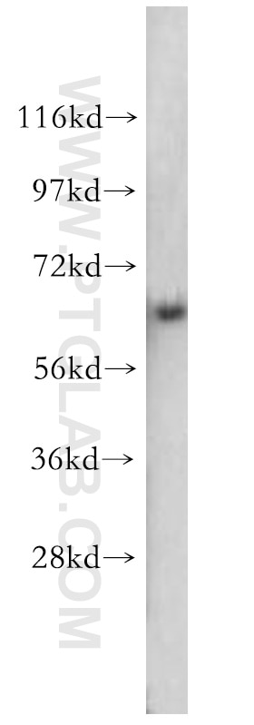 Western Blot (WB) analysis of HEK-293 cells using SMAD4 Polyclonal antibody (10231-1-AP)
