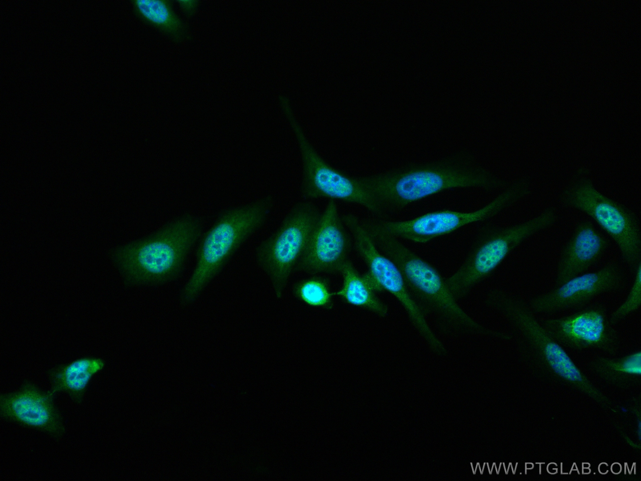 Immunofluorescence (IF) / fluorescent staining of HepG2 cells using SMAD4 Polyclonal antibody (51069-2-AP)