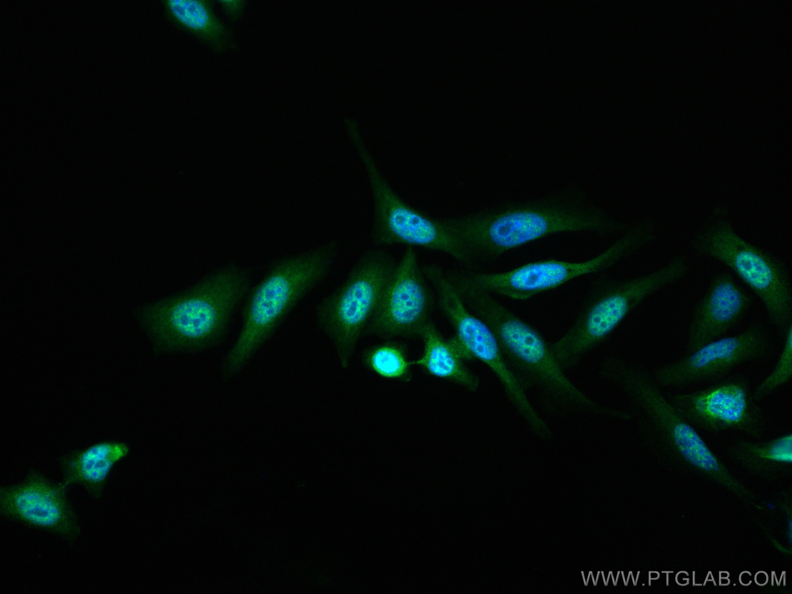 IF Staining of HepG2 using 51069-2-AP